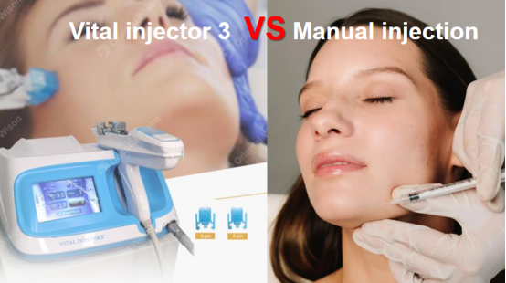 De voordelen van de vitale injector in vergelijking met handmatige injectie