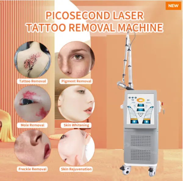 Picosencond Laser --- Hoe effectief tatoeages verwijderen?